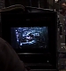 Filename=000022.jpg
Filesize=47KiB
Dimensions=500x281
Date added=Oct 08, 2011 000022.jpg